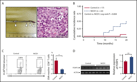 Figure 3. NICD1 mice are susceptible to malignant neoplasms. (A) Representative image showing multiplying soft tissue sarcomas (white triangles) in the tail of NICD1 mice (left) and histological examination by hematoxylin and eosin staining (right). Scale (left panel) in centimeters. (B) Kaplan-Meier curves showing the cumulative incidence rates of soft tissue sarcoma in NICD1 mice and controls. (C) Impaired tumor-specific CD8+ T-cell response in NICD1 mice. NICD1 mice and controls were injected subcutaneously with 5 × 105 B16-OVA melanoma cells. Tumor-infiltrating lymphocytes were isolated and the percentage of OVA-specific CD3+ CD8+ T cells was examined by flow cytometry. The mean percentage of cells from 4 individual mice per group is shown. Data in the bar graphs are expressed as the mean and SEM. *P < .05 (Student t test). (D) Expression of mRNA encoding FOXP3 in inoculated B16-OVA melanoma tissue in NICD1 mice and controls, as evaluated by quantitative PCR. Expression levels are expressed relative to those detected in tumors from control mice. Data in the bar graphs are expressed as the mean and SEM from 4 individual mice per group. **P < .01 (Student t test).