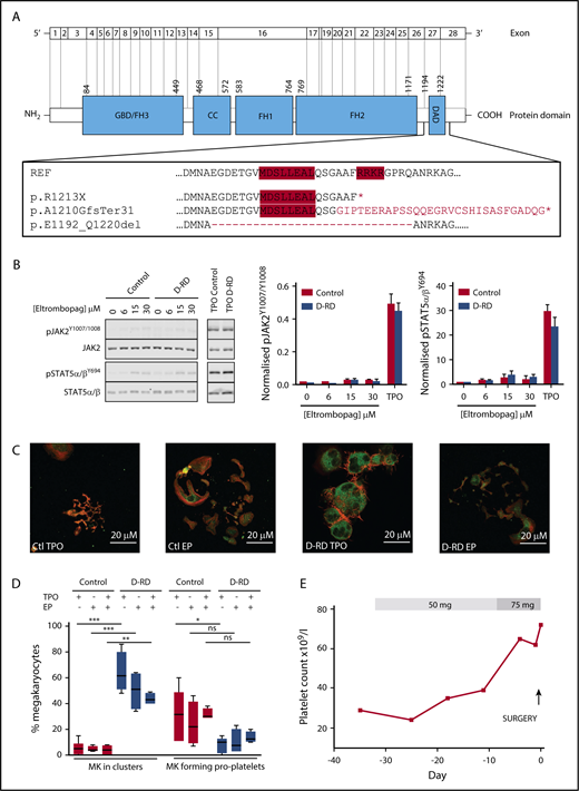 Figure 2. Detailed evaluation of D-RD cases. (A) Schematic representation of DIAPH1 and DIAPH1 protein divided into functional domains, including the DAD near the C terminus. The expanded box shows the wild-type DAD amino acid sequence; the positions of the regulatory RRKR and MDxLLExL sequence motifs are indicated by red shading. The predicted impact of the variants associated with D-RD is shown compared with the reference sequence. The abnormal C terminus amino acid sequence predicted from the p.A1210GfsTer31 variant is indicated in red type. The position of exon 27 residues that are absent with the p.E1192_Q1220del variant is indicated by the dashed line. *Premature stop codon. (B) Representative immunoblot using monoclonal antibodies recognizing p-STAT5α/βY694, total STAT5α/β, pJAK21007/1008, and total JAK2 of lysates from case A-2 and control platelets stimulated with eltrombopag (0-30 μM) or TPO (100 ng/mL) (left panels). Bar graphs of the ratio of phosphorylated/total densitometry signal of 3 D-RD cases (A-2, B-4, and C-9) combined show that eltrombopag causes markedly reduced STAT5α/β and JAK2 phosphorylation compared with TPO and that the extent of phosphorylation in D-RD platelets is the same as controls (middle and right panels). The data are representative of 3 independent experiments expressed as mean ± standard error of the mean. (C) Representative immunofluorescence confocal microscopy images (case A-2 and control) of differentiated peripheral blood–derived CD34+ MKs at day 12 of culture, visualized using anti-integrin β3 (green; CD61) and phalloidin (red; F-actin) staining. In the presence of TPO, D-RD MKs show abnormal clustering, reduced proplatelet formation, and abnormal distribution of F-actin when compared with controls. Reduced proplatelet formation and cluster formation are partially rescued in culture conditions containing eltrombopag (EP). (D) Corresponding bar graphs of aggregate data from duplicate MK-differentiation experiments from 3 unrelated healthy controls and cases A-2, B-4, and C-9, with each of the 3 D-RD variants cultured with TPO (5 μM), EP (3 μM), or TPO (2.5 μM) + EP (2 μM). Data are expressed as mean and standard error of the mean of the percentage of all cultured MKs that associate in clusters and the percentage that are forming proplatelet extensions, as specified in supplemental Methods. (E) Time course of the hematological response to oral eltrombopag administered to case C-9 before elective hip arthroplasty at day 0. Platelet counts were determined using a Sysmex XN analyzer using the fluorescence end point. ***P < .0001, **P < .001, *P < .05, 1-way analysis of variance. ns, not significant.
