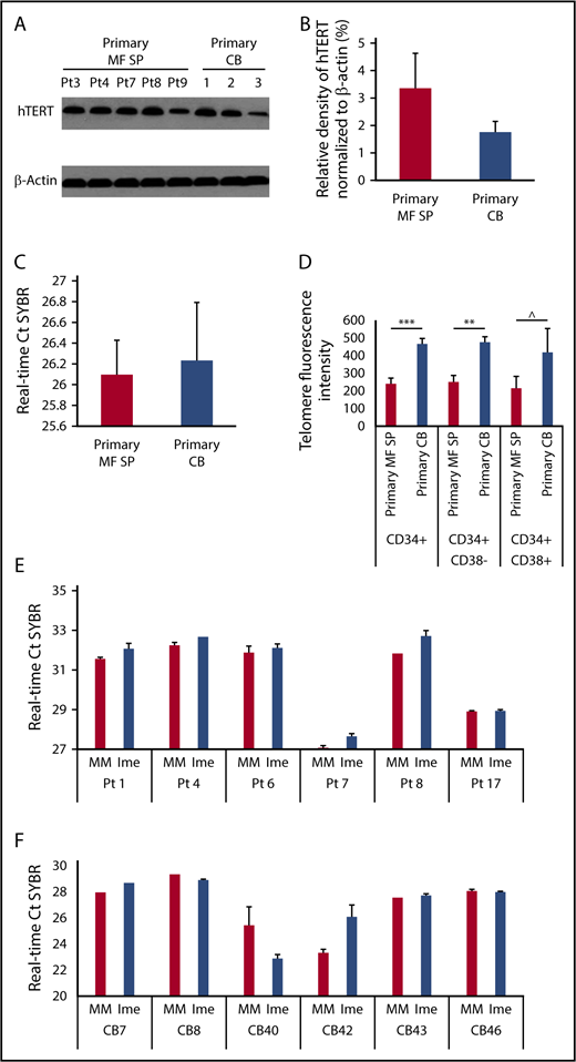 Figure 5. Telomerase expression and activity of normal and splenic MF CD34+ cells. (A) The protein level of hTERT in primary splenic MF and normal CD34+ cells was determined by western blotting with an antibody raised against the hTERT. (B) Densitometric analysis of western blots as represented by panel A shows a similar level of hTERT in primary MF splenic and normal CD34+ cells. MF: n = 5; CB: n = 3. P > .05, MF vs CB. (C) RT-PCR–based assay for TA in primary splenic MF and normal CB CD34+ cells. The higher the Ct value indicates the lower the TA. MF: n = 8; CB: n = 3. P > .05, MF vs CB. (D) Flow-FISH analysis of telomere length of primary splenic MF and normal CB CD34+, CD34+CD38− and CD34+CD38+ cells. The higher telomere fluorescence intensity, the longer telomere. MF: n = 7; CB: n = 4. ***P = .001, **P < .01, ^P = .19. (E-F) RT-PCR–based assay for TA in splenic MF (E) and normal (F) CD34+ cells following the treatment with MM or Ime (7.5 μM) for 7 days. The treatment of MF splenic but not CB CD34+ cells with Ime resulted in a decrease in TA as compared with the treatment with MM. MF and CB: n both = 6. MF: P < .05; CB: P = .87, MM vs Ime.