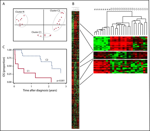 Figure 2. PCA cluster analysis. (A) PCA analysis showing distinct separation of PTCL-NOS tumors from nonneoplastic lymphoid reference tissue and additional clustering within PTCL-NOS in distinct groups (ie, C1 and C2). (B) Hierachical clustering showing distinct protein profiles between N, C1, and C2. With this analysis, 1 of the C2 patients clustered with the C1 group. Green denotes downregulation, and red denotes upregulation. (C) OS of PTCL-NOS patients according to groups (C1 and C2) identified from cluster analysis. N, nonneoplastic lymphoid tissue.