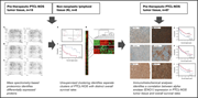 Graphical abstract for: Proteomic profiling identifies outcome-predictive markers in patients with peripheral T-cell lymphoma, not otherwise specified;