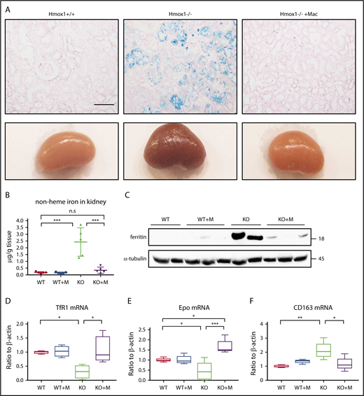 Figure 3. Macrophage infusion prevented pathological accumulation of iron in kidneys. (A) Kidneys (bottom panel) and Perls’ Prussian Blue iron staining of kidney sections (top panel) of WT, Hmox1 KO mice without or with macrophage infusion. Scale bar, 100 μm. (B) Nonheme iron in kidneys of WT and Hmox1 KO mice without or with macrophage infusion. (C) Western blot analysis of ferritin levels in kidneys of WT and Hmox1 KO mice without or with macrophage (Mac) infusion. qRT-PCR analyses of (D) TfR1 (n = 4), (E) erythropoietin (Epo) (n = 5), and (F) CD163 mRNA (n = 4) levels in the kidneys of WT and Hmox1 KO mice without or with macrophage infusion. All animals were infused with macrophages or PBS for 12 weeks. Mean ± SD; statistical analyses were performed using 2-way ANOVA (multiple comparisons). The graphs were created with GraphPad Prism software. *P < .05, **P < .01, ***P < .001.
