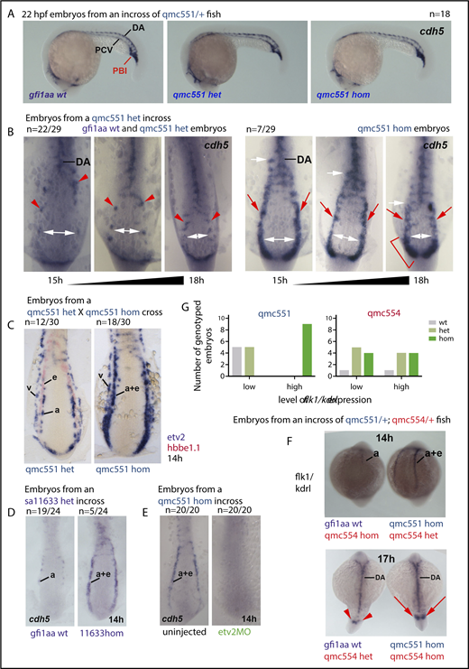 Figure 5. Gfi1aa suppresses the endothelial gene expression program in primitive erythroblasts developing from the posterior lateral mesoderm. The figure shows zebrafish embryos stained in WISH experiments. Lateral views of embryos are shown in panel A. Flat-mounts of the posterior parts of embryos are displayed in panels B-E. Posterior and dorsal views of embryos are presented in the top and bottom panels of F, respectively. (A) Wt, gfi1aaqmc551het, and gfi1aaqmc551hom embryos display very similar cdh5 expression patterns at 22 hpf. Embryos were stained, photographed, and genotyped; 4 of 18 embryos were gfi1aaqmc551hom. Representative wt, gfi1aaqmc551het, and gfi1aaqmc551hom embryos are shown. (B) The expression pattern of the endothelial gene cdh5 is expanded in the posterior lateral mesoderm of Gfi1aa-depleted embryos. A mix of 15 to 18 hpf embryos derived from gfi1aaqmc551het incross were stained for the expression of cdh5, flat-mounted, photographed, and genotyped. Embryo images were sorted on the basis of the level of cdh5 expression and then arranged according to their development stage, which was judged by the distance between the bilateral PLM stripes. In younger embryos, this distance is larger than in older embryos (see white double arrows). Genotyping revealed that all gfi1aaqmc551hom mutant embryos displayed expanded expression patterns for cdh5 in the PLM when compared with wt and gfi1aaqmc551het embryos. The white arrows indicate the anterior extent of the solid stripe of cdh5+ cells in the PLM. Red arrowheads point at normal cdh5 gene expression in dispersed small clusters of PLM cells in wt and gfi1aaqmc551het embryos.28,81 Red arrows highlight unusually robust cdh5 expression in a solid stripe of PLM cells of gfi1aaqmc551hom mutant embryos. A red bracket indicates robust cdh5 expression in the posterior part of the PLM in the 18 hpf gfi1aaqmc551hom embryo. (C) In the absence of Gfi1aa, mRNA for the endothelial transcription factor Etv2 is ectopically expressed in prRBCs. Embryos from a double WISH experiment are shown. Embryos were first stained for the presence of etv2 mRNA in purple, and subsequently with a probe for hbbe1.1 mRNA in red. In the gfi1aaqmc551het embryos, etv2 is expressed in 2 stripes of EC progenitors, arterial (a) progenitors medially and venous (v) progenitors laterally. This is consistent with previous findings in wt embryos.25 Please note that the hbbe1.1-expressing primitive erythroid (e) progenitors are lateral to and much more closely associated with the arterial EC progenitors. In the gfi1aaqmc551hom mutant embryos, the medial stripe of etv2+ cells is wider and encompasses arterial EC progenitors and prRBCs (a+e). Please note that the purple staining in prRBCs masks any red staining that may be present. (D) The cdh5 expression pattern is expanded in gfi1aasa11633 homozygous mutant embryos. Embryos were stained and genotyped. Representative embryos are shown. (E) Endothelial and erythroid cdh5 expression require the presence of the endothelial TF Etv2. Two- and 4-cell stage embryos from a gfi1aaqmc551hom incross were injected with 10 ng of a previous validated etv2 5′ untranslated region (UTR) MO.63,64 Embryos were collected at 14 hpf and stained by WISH. None of the morphant embryos showed any staining. An 18-hpf wt embryo that had been added to the batch of morphant embryos before the WISH experiment showed normal cdh5 expression in ECs (data not shown), confirming that the WISH procedure successfully detected cdh5 mRNA. (F-G) The level of expression of the EC marker flk1/kdrl in the posterior lateral mesoderm correlates with the genotype of gfi1aa, and not with the genotype of gfi1b. In this experiment, gfi1aaqmc551/gfi1bqmc554 double-heterozygous fish were incrossed. Their embryos were stained by WISH, subsequently photographed, and genotyped. Representative embryos with weak and strong staining are shown. The bar charts in (G) summarize the collective results of the gfi1aa and gfi1b genotyping performed on 14- and 17-hpf somite stage embryos that displayed low or high levels of flk1/kdrl expression in the PLM. The flk1/kdrl data support the view that the EC gene upregulation is transient in gfi1aa single- and gfi1aa/1b double-mutant embryos.