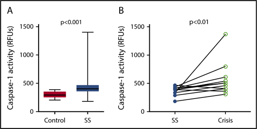 Figure 1. Platelet caspase-1 activity is upregulated in SCD patients in steady state and further increased during an acute pain crisis. Platelet caspase-1 activity is upregulated in SCD patients in steady state (SS) compared with healthy controls (A) and is further elevated when measured in the same SCD patients experiencing an acute pain crisis (paired samples) (B). Data are shown as median with IQR and minimum and maximum values (A) and before-after plot (B). The P values were calculated using the Mann-Whitney U test (A) and the Wilcoxon-signed rank test (B).