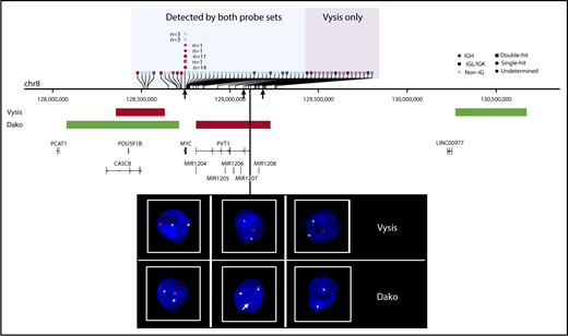 Figure 4. Sensitivity of rearrangement detection at the MYC locus with Vysis and Dako FISH probes. The horizontal axis represents genomic space on chromosome 8 (chr8). Translocations are represented by vertical ticks along the axis, with symbols describing the rearrangement partner labeled above. White crosses denote cases that were MYC break-apart positive by Dako only (ie, Vysis failed). The shaded blue region represents the space where rearrangements can be detected by both assays, and the shaded purple region shows where only Vysis can detect rearrangements. The approximate location of FISH binding probes is shown on the middle track. Representative FISH images show observed patterns: cases in the blue region produce a fusion signal and a break-apart signal in both assays (left); cases with breakpoints that lie within the Dako red probe binding region produce 2 fusion signals and a small additional red signal, as indicated by the white arrow (center); and cases in the purple region produce a break-apart signal with Vysis and 2 fusion signals with Dako (right). Breakpoints corresponding to the FISH images are indicated by black arrows under the chromosome track.