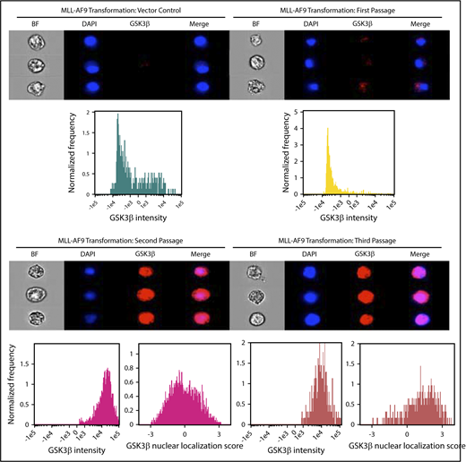 Figure 2. GSK3β is upregulated and exhibits high nuclear localization in mouse hematopoietic progenitor cells after MLL-AF9-mediated transformation. 5-Fluoruracil-mobilized mouse progenitor cells were transduced with vector control or MLL-AF9 and serially passaged in semisolid media for 3 passages or until colonies failed to form. Cells were analyzed by imaging cytometry following each passage for GSK3β intensity and nuclear localization score. Note: no colonies formed for vector control at the second serial passage.