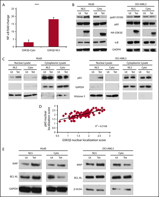 Figure 4. Nuclear GSK3β more potently drives NF-κB activation than cytoplasmic GSK3β. (A) 293T cells were cotransfected with an NF-κB dependent Firefly luciferase construct, a Renilla luciferase vector, and either a vector control or the indicated GSK3β construct. Forty-eight hours posttransfection, cells were analyzed for luciferase signal. Data reported are fold change from the vector control signal and is normalized for Renilla signal (n = 3). (B) The indicated cells with or without targeted GSK3β induction were analyzed for NF-κB signaling components by western blot. Note the NLS isoform is at higher molecular weight because of the construct’s exogenous NLS. (C) HL60 and OCI-AML3 cells were fractionated into nuclear and cytoplasmic lysates and analyzed for p65 nuclear translocation by western blot. (D) Linear correlation analysis of nuclear localization scores of GSK3β and p65 in primary AML samples quantified using imaging cytometry (n = 82). (E) The indicated cells with or without targeted GSK3β induction were analyzed by western blotting for changes in the NF-κB-dependent survival genes, XIAP and Bcl-XL. ***P < .001.