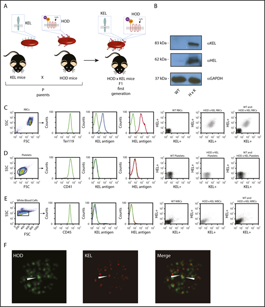 Figure 1. Characterization of HOD × KEL mouse model. (A) Transgenic mice expressing HOD or KEL on their RBC were bred to generate HOD × KEL mice. (B) KEL and HEL expression on WT and HOD × KEL RBC ghosts were determined by western blot analysis. Expression of KEL and HEL was determined by flow cytometry on WT and HOD × KEL RBCs (C), platelets (D), or white blood cells (WBCs) (E), individually and by dual staining of KEL and HEL together. (F) Anti-KEL and anti-HEL binding to HOD × KEL RBC was assessed by super-resolution microscopy (magnification ×100).