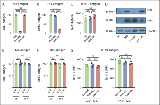 Figure 4. Antibody-induced decreases in the level of detectable antigen reflect antigen-specific removal and not RBC internalization. (A-C) Forty-eight hours posttransfusion into PBS, anti-KEL–, or anti-HEL–treated recipients, HOD × KEL RBC were stained for the level of detectable KEL antigen (A), HEL antigen (B), or Ter119 antigen (C). (D) HOD × KEL RBC ghosts or ghosts from nontransfused mice (NT) were analyzed by western blot by probing for KEL, HEL, and glyceraldehyde 3-phosphate dehydrogenase (GAPDH). (E-G) HOD × KEL RBC were incubated with anti-KEL or anti-HEL antibodies in vitro at 4°C and 37°C for the indicated time and assessed for expression of KEL (E), HEL (F), and Ter119 (G) antigens by flow cytometry. Data in panels A-D and panels E-G are reflective of 2 independent experiments. ****P < .0001 and ns by 1-way ANOVA with Tukey multiple comparison test.