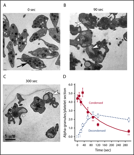 Figure 1. α-Granule decondensation is a kinetic precursor of granule exocytosis. Mouse platelets were stimulated, or not, with thrombin for the indicated times, and reactions were stopped by the addition of glutaraldehyde/paraformaldehyde fixative. Aldehyde fixation can stop secretion in <1 second (cultured hippocampal neurons).38 (A) In electron micrographs of thin sections from unstimulated mouse platelets (0 seconds), α-granules appeared as round to ovoid structures marked by an electron-dense matrix. Upon thrombin stimulation (B-C; 0.1 U/mL), there was distinct accumulation of expanded (ie, decondensed) α-granules marked by residual loose fibrous matrix components. The arrow in panel A points to a condensed α-granule. The arrowheads in panels B-C point to examples of compound-fused, decondensed α-granules. The white star in panel B marks a decondensed α-granule showing variations in apparent matrix density. (D) Quantification of condensed and decondensed granules in platelets stimulated for increasing times. Numbers of platelet profiles scored: 0 seconds/0 time, n = 50; 10 seconds, n = 50; 20 seconds, n = 47; 30 seconds, n = 45; 60 seconds, n = 19; 90 seconds, n = 145; 120 seconds, n = 45; 300 seconds, n = 41. Means and standard errors of the mean are presented, and the graphs are color coded: condensed (red) and decondensed (blue). P values relative to 0 seconds were determined at 90 and 300 seconds. Values for both condensed and decondensed granules were statistically significant for both sets of comparisons. Asterisks indicating statistical significance, as determined with Student t test are as follows: **P ≤ .01.
