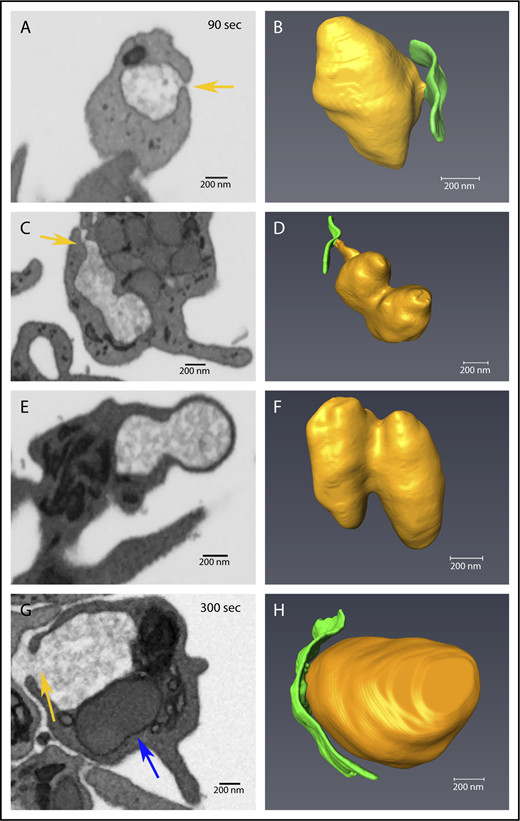 Figure 6. Decondensed α-granule membrane fusion in thrombin-stimulated platelets. Platelets were imaged by FIB-SEM at a nominal resolution of 5 nm in XYZ. Tan arrows point to examples of membrane fusion; 90 seconds stimulation (A-F) and 300 seconds stimulation (G-H). The left column shows single-slice images of platelets, and the right shows rendered images of decondensed granules (tan) and the PM (green). Two image sets show granules that track to the PM at 90 seconds stimulation, in one (A-B), the granule is linked to the PM fusion pore via a short neck, while in the other case the linkage to the fusion pore is by a longer pipe (C-D). (E-F) Two granules fused laterally (compound fusion), and these fail to track to either a PM or CS fusion pore complex. (G-H) A PM-granule fusion at 300 seconds with a larger neck/pipe. The blue arrow in panel G points to a rare condensed α-granule seen in a 300 seconds stimulated platelet. The incidence of α-granule fusion with PM and CS at various time points is quantified in Table 3. Bars represent 0.2 μm.