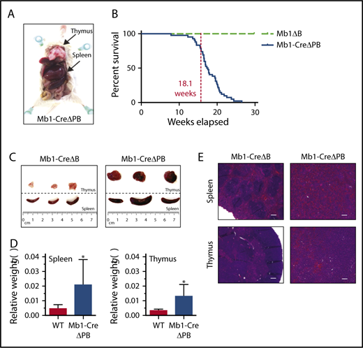 Figure 1. Mb1-CreΔPB mice develop B-ALL. (A) Mb1-CreΔPB mice (ΔPB) mice developed B-ALL characterized by splenic and thymic enlargement (indicated by arrows). (B) Percentage survival of mice of the indicated genotypes: Mb1+/CreSpi1lox/lox Spib−/− (Mb1-CreΔPB; n = 43); Mb1+/CreSpi1+/+ Spib−/− mice (Mb1-CreΔB; n = 36) and Mb1+/+Spi1lox/loxSpib−/− (Mb1-CreΔB; n = 14). (C) Comparisons of enlarged spleens and thymuses extracted from Mb1-CreΔPB mice compared with control ΔB mice (Mb1+/+ Spi1lox/lox Spib−/−). (D) Spleen (left) and thymus (right) weight in grams relative to the body weight in WT and Mb1-CreΔPB mice. WT, n = 10 (spleen), 5 (thymus); Mb1-CreΔPB, n = 11 (spleen), 8 (thymus). Significance was determined using unpaired Student t test. *P ≤ .05. (E). Histologic sections (hematoxylin and eosin staining) of spleen and thymus illustrating the lymphocytic infiltration and loss of organs normal structure in Mb1-CreΔPB compared with controls Mb1ΔB (magnification ×4; scale bar represents 200 μm).