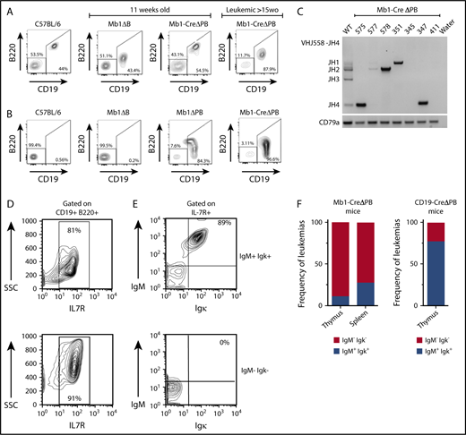Figure 2. Most leukemias from Mb1-CreΔPB mice resemble pro-B cells and do not express either IgM or Igκ at the cell surface. (A) Representative flow cytometric analysis for the presence of CD19+ B220+ B cells in the spleen of C57BL/6 mice; 11-week-old Mb1-CreΔB mice and Mb1-CreΔPB mice (left panels); and >15-week-old Mb1-CreΔPB mice (right panel). (B) Representative flow cytometric analysis for the presence of CD19+ B220+ B cells in the thymus of C57BL/6 mice; 11-week-old Mb1-CreΔB mice, and Mb1-CreΔPB mice (left panels); and >15-week-old Mb1-CreΔPB mice (right panel). (C) Polymerase chain reaction for detection of heavy chain rearrangements (J558-JH4) in leukemia B cells prepared from the thymus of Mb1-CreΔPB mice. B cells prepared from WT mouse (C57BL/6) were used as control. The Cd79 gene was used as control for DNA quality. (D) Representative flow cytometric analysis of leukemic cells from Mb1-CreΔPB mice gated on CD19+ B220+ cells showed that leukemias expressed IL-7R on the cell surface (top and bottom). (E) Representative IL-7R+ leukemias expressing IgM and Igκ, (top, Ig+) and those not expressing IgM and Igκ (bottom, Ig−). (F) Percentage of leukemias expressing IgM and Igκ (Ig+) or not expressing IgM and Igκ (Ig−). (Left) Mb1-CreΔPB mice, n = 14 (spleen) and n = 8 (thymus). (Right) CD19-CreΔPB mice, n = 9 (thymus).