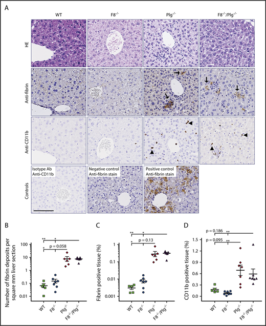 Figure 2. FVIII deficiency did not prevent the development of hepatic fibrin deposits in Plg−/−mice. (A) Representative HE-stained sections and immunohistochemical stains for fibrin and CD11b-expressing inflammatory cells in livers from WT, F8−/−, Plg−/−, and F8−/−/Plg−/− mice. Note the hepatic fibrin deposits (arrows) and CD11b+ cells (arrowheads) in Plg−/− and F8−/−/Plg−/− mice. The anti-CD11b control is a liver section stained with an isotype antibody (Ab). The fibrin-positive and -negative controls are liver sections from WT and fibrinogen−/− mice subjected to CCl4-induced liver injury. Scale bar, 100 µm. The number of fibrin lesions (B) was counted manually, whereas the percentage of fibrin-stained tissue area (C) and the percentage of CD11b-stained tissue area (D) were quantified by digital image analysis. Results are shown as individual observations and mean ± standard error of the mean (SEM). Data were analyzed by the Kruskal-Wallis with Dunn multiple comparisons test. P < .05 was considered significant; *P < .05, **P < .01. All stained slides were scanned at 20× magnification on the Nanozoomer slide scanner (Hamamatsu Photonics K.K.), and quantified with Visiopharm Integrator System software (VIS version 6.7.0.2590; Visiopharm).