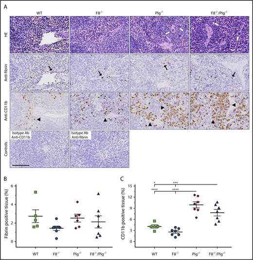Figure 3. FVIII deficiency did not decrease levels of CD11b+cells in the spleen of Plg−/−mice. (A) Representative HE-stained sections and immunohistochemical stains for fibrin and CD11b-expressing cells in spleens from WT, F8−/−, Plg−/−, and F8−/−/Plg−/− mice. Note the presence of fibrin deposits (black arrows) and CD11b-expressing inflammatory cells (arrowheads). Cells with megakaryocyte morphology were abundant in Plg−/− and F8−/−/Plg−/− spleens (white arrows). The anti-CD11b and anti-fibrin–negative controls were spleen sections stained with an isotype antibody. Scale bar, 100 µm. The percentage of fibrin-stained tissue area (B) and percentage of CD11b-stained tissue area (C) were quantified by digital image analysis. Results are shown as individual observations and mean ± SEM and analyzed with an ANOVA with Bonferroni correction for multiple comparisons. P < .05 was considered significant; *P < .05, ***P < .001, ****P < .0001. All stained slides were scanned at 20× magnification on the Nanozoomer slide scanner (Hamamatsu Photonics K.K.), and quantified with Visiopharm Integrator System software (VIS ver. 6.7.0.2590; Visiopharm).