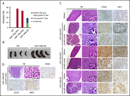 Figure 2. Histological analysis of spleens and lymph nodes in WT mice and representative malignancies in miR-146a or miR-146b KO mice. (A) Increased rate of tumorigenesis in mice with miR-146a or miR-146b ablation. n = 11 (WT), 8 (miR-146a KO1), 3 (miR-146a KO2), and 21 (miR-146b KO). (B) Photograph of spleens isolated from WT and miR-146b KO mice at 16 months. (C) miR-146a and miR-146b KO mice developed B-cell lymphomas in the spleen and lymph nodes. Scale bars represent 500 µm (low magnification), 20 µm (high magnification), and 2.5 µm (insets). (D) miR-146b KO mice developed acute leukemia. Scale bars represent 500 µm (low magnification) and 20 µm (high magnification), and 2.5 µm (inset). HE, hematoxylin and eosin; FL, follicular lymphoma.