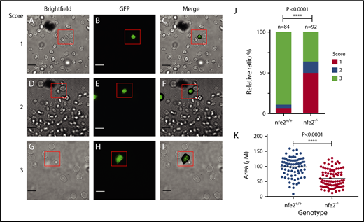 Figure 4. Adult nfe2−/− zebrafish demonstrate decreased ability to spread on fibrinogen. Whole blood was collected from adult zebrafish and applied to glass coverslips pretreated with fibrinogen. Thrombocytes were identified on the basis of Tg(cd41:egfp) fluorescent expression. Images were captured 30 minutes after application of whole blood and analyzed for degree of spreading. The following panels are representative of the scoring system for the spreading assay: images were scored as 1, no spreading (A-C); 2, spreading initiated, but incomplete (D-F); and 3, complete spreading (G-I) by an observer blinded to genotype. Scale bars, 10 μm. Percentages of thrombocytes displaying each score were tabulated for nfe2+/+ and nfe2−/− fish, and mutant fish displayed a significant decrease in spreading compared with wild-type siblings (J; P < .0001). Total thrombocyte area was also quantitated using ImageJ and demonstrated a statistically significant reduction in thrombocyte spreading in mutant fish as well (K; P < .0001). Each point represents the area of an individual thrombocyte. Data were collected from a total of 4 fish for each genotype.