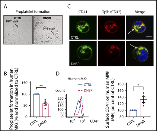 Figure 6. DNM activity is required for optimal PPF and adequate demarcation membrane system (DMS) development. (A-B) PPF representative fields on microscopy imaging and proplatelet (PPT) quantification. PPT stalks are shown with arrow. DNSR-treated MKs had reduced PPF by almost half (paired Student t test P ≤ .01). Images taken by a Nikon Eclipse TS100 (×40 objective) and INFINITY capture camera and software (Luminera), analyzed with INFINITY Analyze software (Luminera). Scale bar represents 100 µm. (C) GpIb (CD42; red) staining of MK plasma membrane and intracellular DMS. Clumps, clustering, and uneven distribution of the DMS were observed within DNSR-treated MKs when compared with control (CTRL) MKs (arrows; supplemental Videos 3 and 4). The CD41 staining (green) showed the same trend of poor distribution within DNSR-treated MKs when compared with CTRL MKs. The nucleus is stained in blue. Images taken by Nikon A1R+ confocal microscope under a 60× Plan-Apochromat oil immersion lens. Scale bar represents 5 µm. (D-E) Representative flow cytometry histograms and flow cytometry quantification of CD41 at the surface of MKs. DNSR-treated MKs showed increased surface expression of CD41 (by 25%; paired Student t test P < .05). Error bars indicate standard errors of the mean of ≥3 independent experiments. *P ≤ .05, **P ≤ .01.