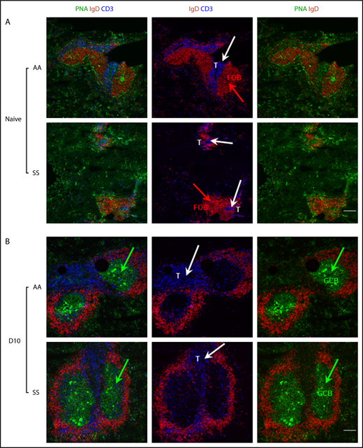 Figure 4. Immunofluorescence analysis of splenic T- and B-cell zones of Townes SS and control mice before and following B microti infection. Representative immunofluorescence images of splenic sections from uninfected (A) and B microti–infected (B) Townes SS and control AA mice (n = 2-3 mice) stained for PNA (a GC marker, using FITC-conjugated PNA, in green), IgD (a B-cell marker, using PE-conjugated anti-IgD, red), and CD3 (a T-cell marker, using APC-conjugated anti-CD3e, blue). Although there is a clear T-cell (blue)/B-cell (red) boundary in the spleens from naive AA mice, T cells are located independently of B-cell follicle, without a clear boundary in the spleens from naive SS mice. GCs marked by PNA in green are formed similarly in both AA and SS mice following Babesia infection. Green arrows indicate clusters of PNA+ GC B cells (GCB); white arrows indicate CD3+ T cells. Scale bars, 200 μm. FOB, follicular B cell.