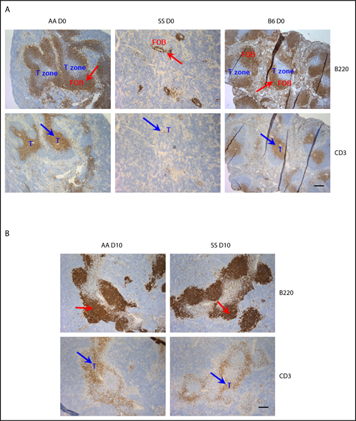 Figure 5. Analysis of splenic follicles of Townes SS and control mice before and following B microti infection. Representative immunohistochemical staining of splenic follicles in Townes SS and control AA and C57BL/6 mice before (A) or after (B, on day 10) B microti infection. Splenic sections were stained for B220 (and detected using horseradish peroxidase (HRP)–linker antibody conjugate with DAP as substrate, brown) and CD3 (and detected using HRP-linker antibody conjugate with DAP as substrate, brown) (n = 2-3 mice). T cells and follicular B cells (FOB) are localized in nonoverlapping areas in the spleens from naive, uninfected C57BL/6, and AA mice. Spleens from naive, uninfected SS mice shows very small indistinct follicles. Following Babesia infection (B), large GCs are formed in the spleens from both AA and SS mice. Red arrows indicate B220+ B-cell follicles; blue arrows indicate CD3+ T cells. T-cell zone is marked in blue. Scale bars, 200 μm.