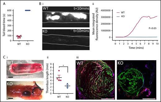 Figure 3. SNAP23 mice show defective hemostasis and arterial and venous thrombosis. (A) Mice anesthetized with a ketamine/xylazine mix had 5 mm of tail tip resected before immediate immersion in 37°C saline. Tail bleeding was followed to the 10-minute experimental end point. N = 5. (B) Mice were infused 0.1 µg/g body weight Dylight-488–conjugated anti-GPIbβ antibody prior to induction of thrombus formation. Thrombus progression was followed for 10 minutes by time-lapse fluorescence microscopy, and representative images of WT (n = 12) and KO (n = 6) of thrombus formation taken under a 4× objective are shown (i) and mean fluorescence intensity for the thrombus is plotted against time after initiation of thrombosis (ii). Data were analyzed by 2-way ANOVA. (C) Mice had their IVCs exposed surgically, and thrombosis was induced by means of a ligature for 48 hours. (i) Representative images are shown of excised vena cavae showing extent of thrombus formation (scale bar = 1 mm). (ii) Thrombus length was recorded after harvest from WT (n = 4) and KO (n = 3) mice. Data were analyzed by Mann-Whitney U test. *P < .05. (iii) Immunohistochemistry was carried out to stain leukocyte marker CD45 (red), platelet marker CD41 (green), and DNA (blue) on venous thrombotic sections, with representative images from WT and KO mice (scale bar = 500 µm).