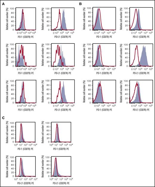 Figure 3. Expression of PD-L1 on the surface of neoplastic MCs in SM. (A-B) KIT+/CD34− BM MCs obtained from 3 patients with ISM (A) and 3 with advanced SM (2 with MCL, 1 with ASM) (B) were stained with antibodies against PD-1 (CD279) (left subpanels) or PD-L1 (CD274) (right subpanels) by multicolor flow cytometry as described in “Materials and methods.” Antibody staining is shown in gray. The isotype-matched control is also shown (red lines and open histograms). (C) The MCL-derived human MC lines HMC-1.1 (KIT D816V−) (left subpanel) and HMC-1.2 (KIT D816V+) (right subpanel) were stained with antibodies against PD-1 (top subpanels) or PD-L1 (bottom subpanels).