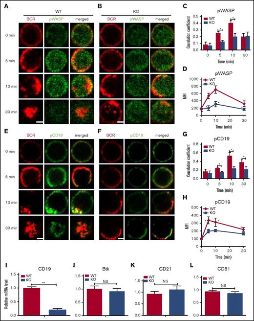 Figure 3. The recruitment of pWASP and pCD19 to BCR clusters in B cells stimulated by sAg is decreased in Dock8 KO B cells. Murine splenic B cells were incubated with AF546–mB-Fab′–anti-Ig without or with streptavidin (sAg) at 4°C, washed, and warmed to 37°C for varying lengths of time. After fixation and permeabilization, the cells were stained for pWASP and pCD19 and analyzed using CFm (A-C,E-G) or flow cytometry (D,H). Flow cytometry analysis of the MFI of pWASP (D) and pCD19 (H) after stimulation with sAgs. The Pearson’s correlation coefficients between BCR and pWASP (C) or between BCR and pCD19 (G) staining in sAg-stimulated cells were determined using NIS-Elements AR 3.2 software. The relative mRNA levels of cd19, btk, cd21, and cd81 in splenic B cells examined by RT-PCR (I-L). Shown are representative images in which more than 50 cells were individually analyzed using NIS-Elements AR 3.2 software; shown are mean values (±SD) from 3 independent experiments. Scale bars, 2.5 μm. *P < .01; **P < .001.