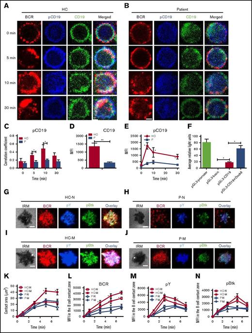 Figure 6. Dock8 deficiency disrupts the activation and transcription of CD19 as well as the early activation of memory B cells. Human B cells from HCs and Dock8 patients were incubated with AF546–mB-Fab′–anti-Ig without or with streptavidin (sAg) at 4°C, washed, and warmed to 37°C for varying lengths of time. (A-E) After fixation and permeabilization, the cells were stained for pCD19 and CD19 and analyzed using CFm (A-D) or flow cytometry (E). (C) The Pearson’s correlation coefficients between BCR and pCD19 staining in sAg-stimulated cells were determined using NIS-Elements AR 3.2 software. (D) The MFI of CD19 in B cells from HC and Dock8 patients was measured by NIS-Elements AR 3.2 software. (E) The MFI of pCD19 in sAg-stimulated cells were determined by flow cytometry. (F) Two hundred ninety-three cells in 24-well plates were transfected with 0.45 μg pGL3-CD19, 0.45 μg pcDNA3.1, or pcDNA3.1-Dock8 and 0.045 μg pRL-TKB (internal control) for 24 hours, followed by luceferase reporter assay; pGL3-promoter and pGL3-basic were used as positive and negative controls. TIRFM and interference reflection microscopy analysis of pY and pBtk staining in the contact zone of naïve and memory B cells from HCs and Dock8 patients incubated with membrane-tethered Fab′–anti-Ig. Shown are representative images (G-J) and the B-cell contact area (K), the MFI of Fab′–anti-Ig in the B-cell contact zone (L), MFI (±SD) of pY (M), and pBtk (N) in the B-cell contact zone from 3 independent experiments. All 3 patients were included, and each patient was an independent experiment. Scale bars, 2.5 µm. *P < .01; **P < .001, in comparison with naïve B cells from Dock8 patients. M, memory B cell; N, naïve B cell.