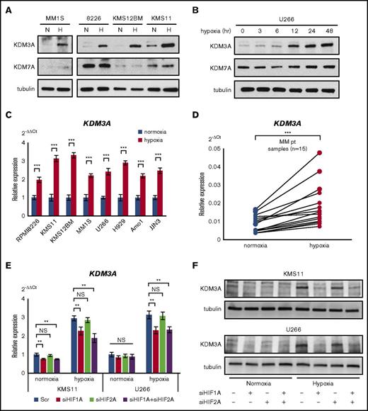 Figure 2. KDM3A is upregulated via HIF-1α activation in hypoxia-stressed MM. (A) Western blot analysis of KDM3A and KDM7A for indicated cell lines cultured in normoxia or hypoxia (1% O2) for 48 hours. H, hypoxia; N, normoxia. (B) Western blot analysis of KDM3A and KDM7A in U266 cell line cultured in hypoxia (1% O2) for 0, 3, 6, 12, 24, and 48 hours. (C) qRT-PCR of KDM3A for indicated cell lines cultured in normoxia or hypoxia (1% O2) for 48 hours. Bars represent mean ± 95% CI of 3 independent experiments. ***P < .001. Student t test was used to test for significance. (D) qRT-PCR of KDM3A for primary myeloma samples (n = 15) cultured in normoxia or hypoxia (1% O2) for 48 hours. ***P < .001. Student t test was used to test for significance. (E) qRT-PCR of KDM3A for KMS-11 and U266 cell lines transiently transduced with siHIF1A and/or siHIF2A and control scrambled siRNA (Scr) and cultured in normoxia or hypoxia (1% O2) for 48 hours. Bars represent mean ± 95% CI of 3 independent experiments. **.001 ≤ P < .01. Student t test was used to test for significance. (F) Western blot analysis of KDM3A for KMS-11 and U266 cell lines transiently transduced with siHIF1A and/or siHIF2A and control scrambled siRNA and cultured in normoxia or hypoxia (1% O2) for 48 hours. NS, not significant.