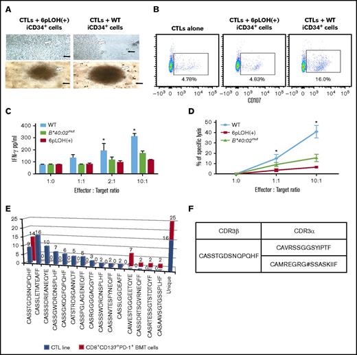 Figure 5. Escape of B4002−iCD34+ cells from the attack by autologous CTLs specific to B4002+ iCD34+ cells. (A) CTLs were cocultured with iCD34+ cells possessing either the 6pLOH+ or the WT genotypes in 96-well round-bottom plates for 5 days and visualized using a light microscope. Representative images of experiments are shown; black arrows indicate iCD34+ cells; white arrows indicate CTLs. Top panels, original magnification ×60; bottom panels, original magnification ×20. (B) CTLs were cocultured with iCD34+ cells possessing either the 6pLOH+ or the WT genotypes in 96-well round-bottom plates at a 10:1 effector:target (E:T) ratio for 4 hours and then analyzed by FCM. The analysis was performed by gating cells as 7-aminoactinomycin D–negative (live cells), CD3+, CD8+, or CD107a+ cells. (C) CTLs were cocultured in 96-well round-bottom plates with iCD34+ cells with 6pLOH+, WT, or B*40:02mut genotypes at the indicated E:T ratios. The levels of IFN-γ in the supernatants from overnight cocultures were determined by enzyme-linked immunosorbent assay. Summarized data (mean ± SEM) from 3 independent experiments are shown. (D) iCD34+ cells possessing the 6pLOH+, B*40:02mut, or WT genotypes were labeled with 51Cr and then cocultured with autologous CTLs in 96-well round-bottom plates for 4 hours. Summarized data (mean ± SEM) from 3 independent experiments are shown. (E) Clonotype analysis (Vβ cDNA sequencing) of the CTL line and BM T cells of the patient before receiving immunosuppressive therapy using single T-cell RT-PCR indicate that the third-most recurrent TCRVβ CDR3 sequence of the CTL line was identical to that of the most predominant T-cell clone in the BM. (F) CDR3α sequence of T cells with the same CDR3β sequence derived from the CTL line and BM T cells. The T cell expressed 2 TCRα chain mRNAs; 1 was functional and the other was unproductive. *P < .05.