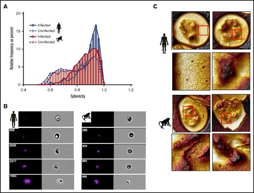 Figure 4. Ultrastructural and geometrical comparison of iRBCs and uRBCs from humans and M fascicularis monkeys with knowlesi malaria. (A) The sphericity (approximate aspect ratio) of iRBCs and uRBCs from 3 humans and 3 M fascicularis monkeys with knowlesi malaria, as determined by single-event flow cytometry (Amnis). In both species, sphericity was increased in iRBCs vs uRBCs. (In 3 humans, the median aspect ratio of iRBCs was 0.91, 0.87, and 0.93, respectively, vs 0.77, 0.84, and 0.84 for uRBCs, respectively; P < .0001. In 3 monkeys, the median aspect ratio of iRBCs was 0.87, 0.85, and 0.87, respectively, vs 0.83, 0.81, and 0.84 for uRBCs, respectively; P < .0001). Sphericity was increased in human iRBCs compared with monkey iRBCs (P < .0001). (B) Examples of images captured from the flow cytometer of P knowlesi iRBCs stained with Hoechst stain, ordered from earliest asexual forms (ring stage) to mature forms (schizonts). (C) Atomic force scans of P knowlesi iRBCs from humans (upper 4 images) and M fascicularis monkeys (lower 4 images) demonstrating increased sphericity of the human iRBCs. In each group of 4 images, the bottom 2 images (side = 2 μm) represent the magnified area in the image directly above (side = 8 μm) indicated by a red square, and show caveola pits.