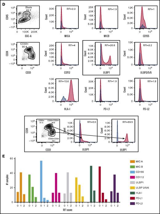 NKRLs are variably expressed by AML blasts. The expression of 6 activating (MICA, MICB, CD155, CD112, ULBP1, and ULBP2/5/6) and 3 inhibitory (PD-L1, PD-L2, and HLA class I) NKRLs was detected by flow cytometry on cryopreserved bone marrow blasts harvested from 66 patients with a new diagnosis of AML. Side scatter (SSC-A) and CD45 were used to gate the blast population. CD33 and CD34 were used as additional markers of disease. The RFI was calculated for each ligand as follows: mean fluorescence intensity (MFI) of the ligand/MFI of the unstained control. (A) NKRL RFIs calculated and plotted for all 66 patients. Each replicate is shown; black horizontal line corresponds to median values. (B) Representative plots of a patient expressing only inhibitory ligands (HLA-I and PD-L2). (C) Representative plots of a patient with high expression of both activating and inhibitory NKRLs. (D) Representative plots of a patient with a double blast population (CD33posCD34pos and CD33posCD34dim), where the expression of ULBP1 was strikingly different: the CD33posCD34pos blasts expressed low levels of ULBP1 (RFI = 5.5), whereas the activating ligand was highly expressed on CD33posCD34dim cells (RFI = 69.5). Blue histograms correspond to unstained control MFI; red histograms correspond to NKRL MFI. (E) An RFI score ranging from 0 to 2 was calculated for each ligand as follows: (1) samples with RFI <2 (ie, less than twofold increase of median fluorescence above background) were considered negative and assigned score 0; (2) Samples with an RFI value between 2 and the III quartile were assigned score 1; (3) Samples with RFI equal to or above the III quartile were assigned score 2. Panel E represents the distribution of patients according to the RFI score for each NKRL.