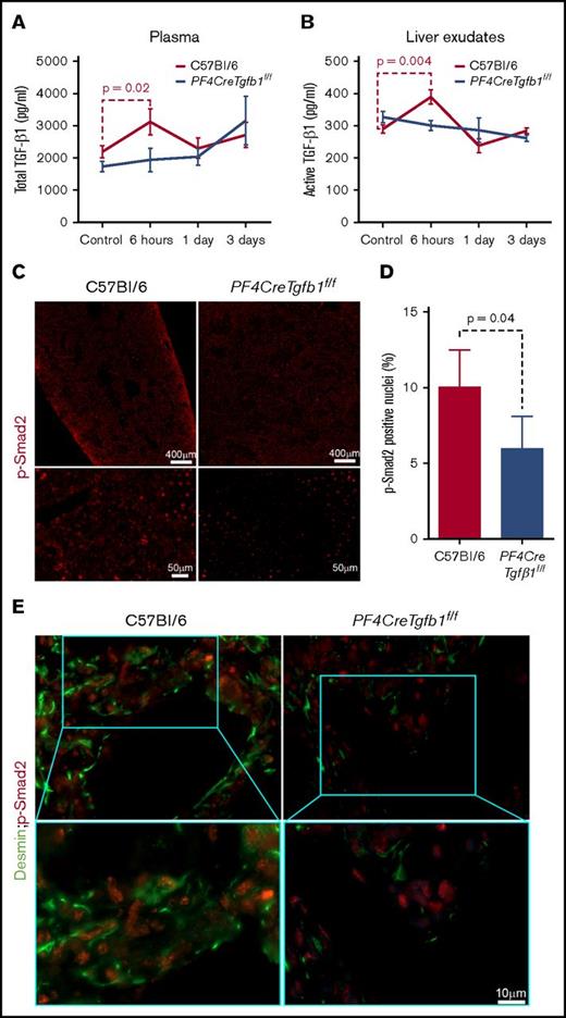 Figure 4. Total and active TGF-β1 and p-Smad2 levels increase transiently after acute CCl4 challenge in WT mice but not in PF4CreTgfb1f/f mice. (A) Total TGF-β1 levels in the plasma of WT and PF4CreTgfb1f/f mice at the indicated time points were measured with a modified ELISA protocol using DuoSet kits from R&D Systems. There was a transient increase in the total plasma TGF-β1 in WT mice (n = 7) but not in PF4CreTgfb1f/f mice at 6 hours (n = 9). (B) Both active and total TGF-β1 levels in liver exudates were measured by ELISA. Active TGF-β1 levels were higher in WT liver exudates than in PF4CreTgfb1f/f liver exudates at 6 hours (n = 5; P = .004). (C) p-Smad2 immunostaining showed that most of the phosphorylated signals were in the nuclei (red dots in the tiled pictures of the whole-liver section in the top panels and magnified injured areas in the bottom panels), showing lower levels of p-Smad2 in the injured liver areas of PF4CreTgfb1f/f vs WT mice at 3 days after CCl4 challenge. (D) Quantification of p-Smad2 intensity in the injured areas of the liver sections showed that PF4CreTgfb1f/f livers had fewer p-Smad2 cells than did those of WT mice (n = 4; P = .04). (E) Sequential dual staining with p-Smad2 and desmin antibodies showed that most of the cells expressing p-Smad2 were desmin-positive HSCs in the injured areas of the liver at 3 days after CCl4 challenge.