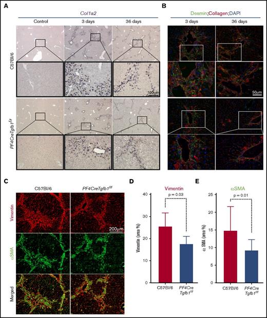 Figure 5. PF4CreTgfb1f/f mice have fewer collagen-expressing HSCs and myofibroblasts than WT mice. (A) In situ hybridization of the Col1a2 probe showed higher collagen-expressing cell accumulation in the injured areas of the liver in WT vs PF4CreTgfb1f/f mice at 3 days and 36 days after CCl4 challenge. Higher-magnification images (boxed) showed that the morphology of those cells resembled HSCs. (B) To confirm that they were HSCs, liver sections were costained with anti-desmin and collagen antibodies; double-positive cells started to appear at 3 days and in the fibrotic areas at 36 days after CCl4 challenge. (C) Dual staining with myofibroblast markers αSMA (green) and vimentin (red) showed double-positive (yellow) cells at 36 days after CCl4 challenge in the WT and PF4CreTgfb1f/f mice. Quantification of vimentin- (D) and αSMA- (E) positive cells in PF4CreTgfb1f/f (n = 7) vs WT (n = 12) mice. DAPI, 4′,6-diamidino-2-phenylindole.