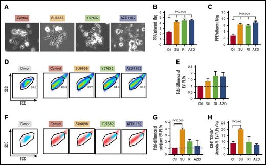 Figure 5. Influence of inhibitors on in vitro proplatelet formation and released EV-PLPs. (A) Representative fields of megakaryocytes extending proplatelet shafts and branching extensions on fibronectin-coated plates. Original magnification ×200. (B) Proplatelet protrusions (PPP) and (C) proplatelet extensions (PPE) were quantitated on day 12 megakaryocytes that had or had not been exposed to the various inhibitors. Mean ± 1 SEM are shown with N = ≥20 cells counted per condition. P values were determined using 1-way ANOVA in comparison with the control. (D) Representative FSC vs SSC for hdPlts (Donor, left), and PLPs harvested from the media from day 12 plates of control and treated megakaryocytes (right 4 graphs). (E) Shows a difference in number of EV-PLPs (from the normal donor Plt FSC/SSC window) obtained from treated megakaryocytes in reference to control ones. (F) Representative FSC vs SSC for hdPlt (Donor, left), and EV-PLPs harvested from the media from day 12 plates of control and treated megakaryocytes (right 4 graphs). The blue indicates CD42b+ hdPlts and EV-PLPs among all others released particles. (G) Fold-difference in number of CD41+CD42b+AnnexinV− (uninjured) EV-PLPs obtained from treated megakaryocytes in reference to control ones. Mean ± 1 SEM are shown with N = 3 independent experiments. P values were determined using 1-way ANOVA in comparison with the control. (H) Percentage of healthy EV-PLPs (as in panel G) compared with the entire EV-PLP population. Mean ± 1 SEM are shown with N = 3 independent experiments. P values were determined using 1-way ANOVA in comparison with the control.