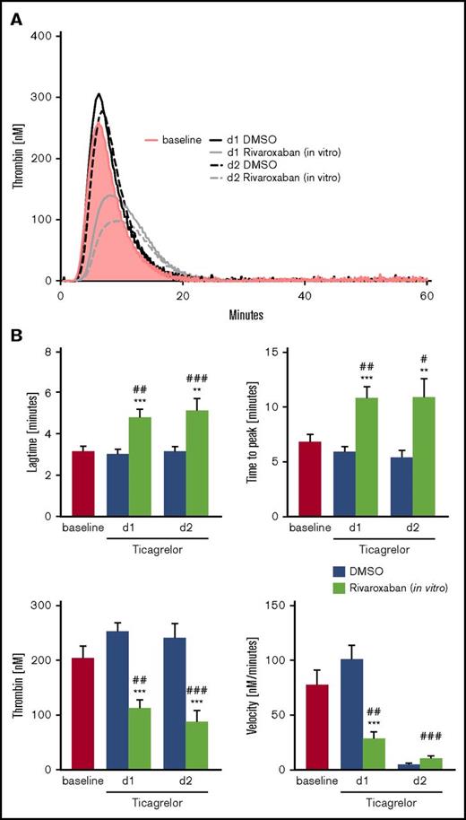 Figure 2. TG in PPP of patients with NSTEMI treated with ticagrelor in the presence or absence of VLD rivaroxaban. (A) Representative tracings and (B) arithmetic means ± SEM (n = 20) of lag time, TTP, peak (thrombin), and velocity of TG in PPP of patients with NSTEMI before (baseline) and after medication with ticagrelor + ASA for 1 and 2 days (d1 and d2) in the absence (DMSO) or presence of 40 ng/mL rivaroxaban (in vitro). **P < .01 and ***P < .001 indicate statistically significant differences from solvent control at the indicated time point. #P < .05, ##P < .01, and ###P < .001 indicate significant differences from baseline.