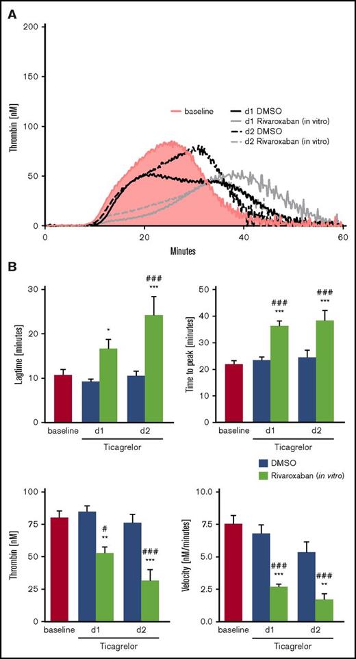 TG in PRP of patients with NSTEMI treated with ticagrelor in the presence or absence of VLD rivaroxaban. (A). Representative tracings of TG in PRP of patients with NSTEMI before (baseline) and after medication with ticagrelor + ASA for 1 and 2 days (d1 and d2) in the absence (DMSO) or presence of 40 ng/mL rivaroxaban (in vitro) with resting platelets and (C) with 10 µg/ml CRP-stimulated platelets. (B) Arithmetic means ± SEM (n = 20) of lag time, TTP, peak (thrombin), and velocity of TG in PRP of patients with NSTEMI before (baseline) and after treatment with ticagrelor for 1 and 2 days (d1 and d2) in the absence (DMSO) and presence of 40 ng/mL rivaroxaban (in vitro) with resting platelets and (D) with 10 µg/mL CRP stimulated platelets. *P < .05, **P < .01, and ***P < .001 indicate statistically significant differences from solvent control at the indicated time point. #P < .05 and ###P < .001 indicate significant differences from baseline.