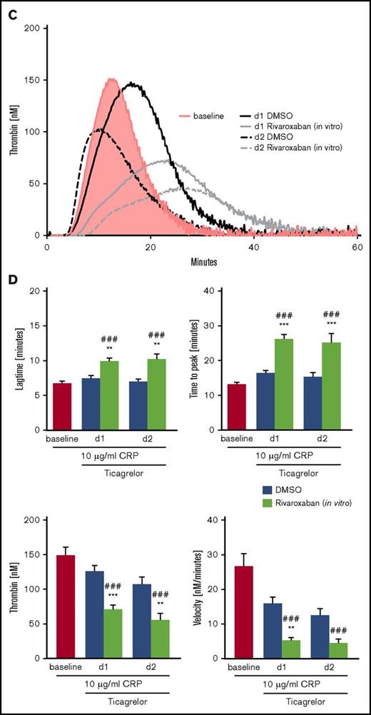 TG in PRP of patients with NSTEMI treated with ticagrelor in the presence or absence of VLD rivaroxaban. (A). Representative tracings of TG in PRP of patients with NSTEMI before (baseline) and after medication with ticagrelor + ASA for 1 and 2 days (d1 and d2) in the absence (DMSO) or presence of 40 ng/mL rivaroxaban (in vitro) with resting platelets and (C) with 10 µg/ml CRP-stimulated platelets. (B) Arithmetic means ± SEM (n = 20) of lag time, TTP, peak (thrombin), and velocity of TG in PRP of patients with NSTEMI before (baseline) and after treatment with ticagrelor for 1 and 2 days (d1 and d2) in the absence (DMSO) and presence of 40 ng/mL rivaroxaban (in vitro) with resting platelets and (D) with 10 µg/mL CRP stimulated platelets. *P < .05, **P < .01, and ***P < .001 indicate statistically significant differences from solvent control at the indicated time point. #P < .05 and ###P < .001 indicate significant differences from baseline.