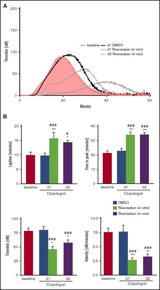TG in PRP of patients with NSTEMI treated with clopidogrel in the presence or absence of VLD rivaroxaban. (A) Representative tracings of TG in PRP of patients with NSTEMI before (baseline) and after medication with clopidogrel + ASA at d1 in the absence (DMSO) or presence of 40 ng/mL rivaroxaban (in vitro), as well as after medication with clopidogrel + ASA and 2.5 mg rivaroxaban twice daily at d2 (in vivo) with resting platelets and (C) with 10 µg/mL CRP-stimulated platelets. (B) Arithmetic means ± SEM (n = 20) of lag time, TTP, peak (thrombin), and velocity of TG in PRP of patients with NSTEMI before (baseline) and after medication with clopidogrel + ASA at d1 in the absence (DMSO) or presence of 40 ng/mL rivaroxaban (in vitro) as well as after medication with clopidogrel + ASA and 2.5 mg rivaroxaban twice daily at d2 (in vivo) with resting platelets and (D) with 10 µg/mL CRP-stimulated platelets. *P < .05, **P < .01, and ***P < .001 indicate statistically significant differences from solvent control at the indicated time point. #P < .05 and ###P < .001 indicate significant differences from baseline.