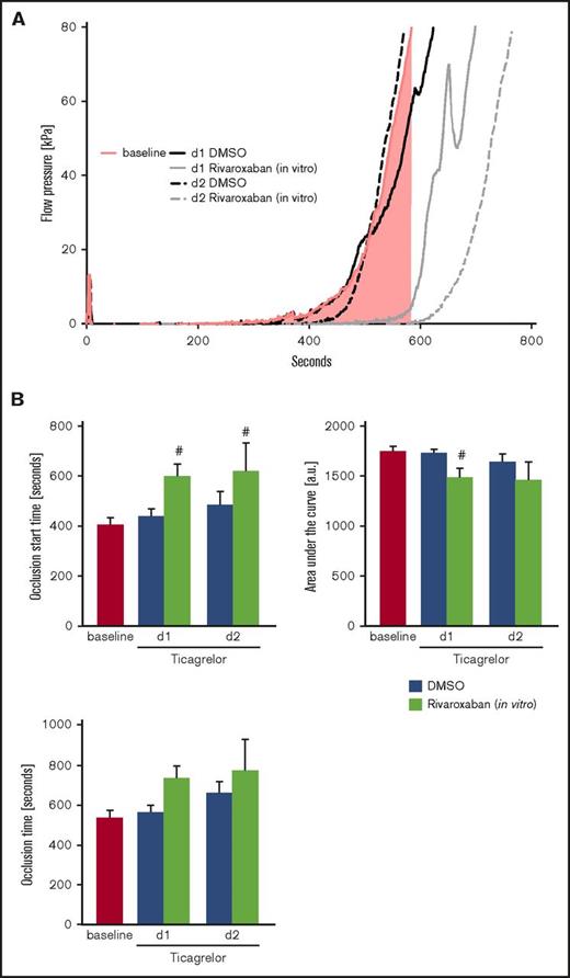 Figure 6. Total thrombus formation of patients with NSTEMI treated with ticagrelor in the presence or absence of VLD rivaroxaban. (A) Representative tracings and (B) arithmetic means ± SEM (n = 12) of occlusion start time (T10), AUC and OT of total thrombus formation on a collagen and tissue factor coated (AR) chip in recalcified citrated whole blood from patients with NSTEMI before (baseline) and after medication with ticagrelor + ASA for 1 and 2 days (d1 and d2) in the absence (DMSO) or presence of 40 ng/mL rivaroxaban (in vitro). #P < .05 indicates significant differences from baseline.