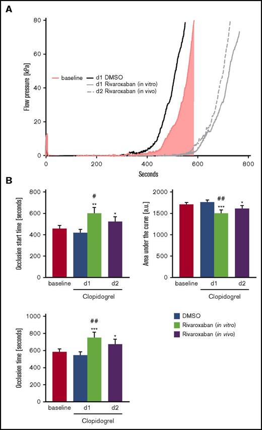 Figure 7. Total thrombus formation of patients with NSTEMI treated with clopidogrel in the presence or absence of VLD rivaroxaban. (A) Representative tracings and (B) arithmetic means ± SEM (n = 14) of occlusion start time (T10), AUC, and OT of total thrombus formation on a collagen- and tissue factor-coated (AR) chip in recalcified citrated whole blood from patients with NSTEMI before (baseline) and after medication with clopidogrel + ASA at d1 in the absence (DMSO) or presence of 40 ng/mL rivaroxaban (in vitro), as well as after medication with clopidogrel + ASA and 2.5 mg rivaroxaban twice daily at d2 (in vivo). *P < .05, **P < .01, and ***P < .001 indicate statistically significant differences from solvent control at the indicated time point. #P < .05 and ##P < .01 indicate significant differences from baseline.