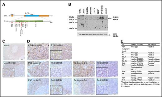 Figure 1. Deleterious variants identified in S1PR1 gene resulted in reduced expression of S1PR1. (A) The distribution of S1PR1 variants identified in the discovery and extended cohort of MCL patients. Altogether, 200 Swedish MCL samples from 179 patients were screened by WES and/or Sanger sequencing. Most of the variants identified in S1PR1 were frameshift insertion or deletions (indels). In P9, an identical mutation (p.S123Efs) was detected in all 3 samples. In P47, 2 mutations were detected. (B) S1PR1 protein expression in a fibroblast cell line (WB detection) transfected with wild-type (WT) or mutant S1PR1 constructs; β-actin was used as a loading control. In lane 2, a band between 15 and 20 kDa is detected, which is probably nonspecific because the mutations would lead to a truncated protein of ∼35 kDa. IHC staining of S1PR1 in control tonsil samples (C; note S1PR1 expression in the mantle zone of germinal centers) and in representative MCL cases (D) carrying WT (P7) or mutated S1PR1 (P56, P36, P45; note that in P45 different tumor areas vary in S1PR1 expression); magnification ×200. (E) The full summary on the S1PR1 expression by IHC in MCL cases.