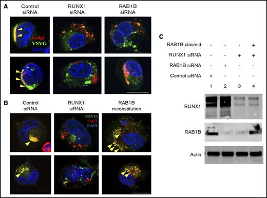 Figure 4. Regulation of ER-to-Golgi transport by RUNX1 and RAB1B in HEL cells. (A) PMA-treated HEL cells cotransfected with VSVG-GFP and E2 Crimson-GalT, along with siRNAs and plasmid constructs as indicated, were seeded on coverslips, kept at 40°C for 16 hours, and then transferred to 32°C for 30 minutes and fixed. VSVG, green; GalT, red; DAPI, blue. Yellow arrowheads indicate areas of VSVG in Golgi structures, indicated by colocalization with GalT, which appears as yellow. Bar, 10 μm. VSVG and GalT were colocalized intact in the cells transfected with control siRNA (Pearson’s correlation coefficient r = 0.609 ± 0.035; mean ± SEM). In cells transfected with RUNX1 siRNA (r = 0.378 ± 0.033; P < .05) or RAB1B siRNA (r = 0.374 ± 0.026; P < .05), Golgi was disrupted and there was no accumulation of VSVG-GFP, as RAB1B facilitates VSVG transport. (B) Resumption of VSVG transport by reconstituted RAB1B in HEL cells after RUNX1 siRNA downregulation (r = 0.711 ± 0.046; P = NS compared with control). Bar, 10 μm. (C) Immunoblot analysis showing reconstitution of RAB1B protein by ectopic RAB1B expression in RUNX1-depleted HEL cells.