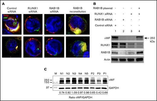 Figure 5. Effect of siRNA depletion of RAB1B and RUNX1 on vWF trafficking in HEL cells. (A) PMA-treated HEL cells were transfected with siRNAs and expression plasmid, as indicated and as described in the legend for Figure 4. In control siRNA-transfected cells, vWF (green) colocalized with the Golgi (E2-Crimson-GalT, red; Pearson correlation coefficient r = 0.793 ± 0.018). On treatment with RUNX1 siRNA (r = 0.478 ± 0.072; P < .05; compared with control) or RAB1B siRNA (r = 0.429 ± 0.082; P < .05), Golgi structures were disrupted and the colocalization with vWF was lost. RAB1B expression in RUNX1 siRNA-depleted cells reconstituted the Golgi structures along with colocalization of vWF (r = 0.665 ± 0.082; P = NS), similar to that seen in control cells. Bar, 10 μm. (B) Immunoblot analysis of vWF, RUNX1, RAB1B, and actin in HEL cells treated as described earlier. Downregulation of RAB1B or RUNX1 decreased vWF; reconstitution of RAB1B in RUNX1-depleted cells restored the vWF. (C) Platelet vWF by immunoblotting in 3 patients with RUNX1 mutations and 5 normal subjects. Also shown is the ratio of vWF to GAPDH as loading control.
