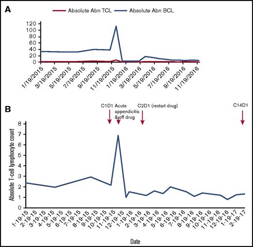 Figure 1. Response in 1 patient who achieved a partial response to ibrutinib therapy with SS/MF and CLL. (A) Ibrutinib therapy resulted in significant decrease in both abnormal (Abn) B-cell (CLL) and Abn T-cell (Sezary) populations. (B) The patient’s Sezary population at baseline was 2370 cells/mm3; after ibrutinib therapy, his Sezary population has ranged from 803 to 2000 cells/mm3, most recently being 1325 cells/mm3. He had a marked rise in white blood cell count in the setting of acute appendicitis in December 2015. Ibrutinib was held for 84 days during appendicitis treatment (antibiotics and surgery) and recovery. Ibrutinib was restarted March 2016, and the patient has continued on therapy to date.