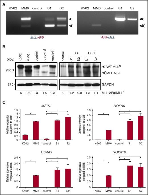 Figure 2. Transcriptional features of genome-edited MLL-AF9 translocated cells. (A) RT-PCR was performed on complementary DNA of genome-edited MLLr cells from 2 independent cultures to detect fusion transcripts. Closed arrowheads indicate MLL-AF9 and AF9-MLL fusion transcripts. Open arrowheads indicate the alternatively processed fusion transcripts, which lack MLL exon 11 and MLL exon 12 from MLL-AF9 and AF9-MLL, respectively. (B) Representative western blot analysis of MLL proteins in controls (nucleofected with GFP alone) and MLL-AF9–rearranged cells cultured either in liquid or semisolid medium. Retroviral and knock-in indicate transformed human cord blood cells by retroviral MLL-AF9 or MLL-AF9 knock-in. CFC, colony-formed cells; GAPDH, loading control; LC, liquid culture. Numbers below indicate relative MLL-AF9 band intensities compared with WT MLLN. (C) Representative qPCR analyses show expression levels of MLL target genes compared with control (nucleofected with GFP) at day 65 of culture and human leukemia cell lines. *P < .02. Error bars indicate standard deviation of triplicate analyses. MM6, Mono Mac 6; S1, sample 1; S2, sample 2; WT, wild-type.