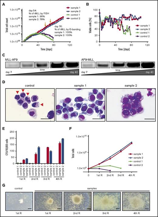Figure 4. Genome-edited primary CD34+ cells display survival advantage and clonal expansion in vitro. (A) Representative growth curves chart the differences in proliferative capacity of genome-edited CD34+ cells compared with controls (GFP or MLL TALENs alone). Arrows indicate time point of FISH analyses and karyotyping. (B) Graph shows cell viability in liquid culture monitored over time by flow cytometry and further confirmed by trypan blue dye exclusion. (C) PCR was performed for MLL-AF9 and reciprocal AF9-MLL breakpoints on genomic DNA over progressive time of culture. (D) Representative morphologies are shown for control and translocated cells on day 76 by May-Grünwald-Giemsa staining. Arrowheads indicate differentiating cells. Scale bar, 20 μm. (E) Colony-forming assays were performed on day 60 of liquid culture. Bars represent the mean number of colony-forming units (CFUs) per 104 seeded cells. (F) Plot indicates cell numbers after each replating. Experiments were performed in triplicate, and data from 2 independent experiments are shown. (G) Images show representative morphologies of colonies after each replating (R). Scale bar, 200 μm.