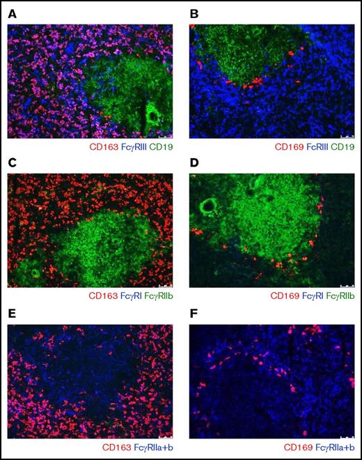 Figure 1. Immunofluorescence of spleen tissue shows FcγR expression pattern of splenic macrophages. Immunofluorescent costainings of (A) CD163, FcγRIII, and CD19; (B) CD169, FcγRIII, and CD19; (C) CD163, FcγRI, and FcγRIIb; (D) CD169, FcγRI, and FcγRIIb; (E) CD163 and FcγRIIa+b; and (F) CD169 and FcγRIIa+b. Original magnification ×10. CD163 marks the red pulp macrophages, CD169 marks the perifollicular zone macrophages, CD19 marks B cells in the follicles. B cells in the follicle are also positive for FcγRIIb. Figures are representative of n = 3 spleens from different donors.