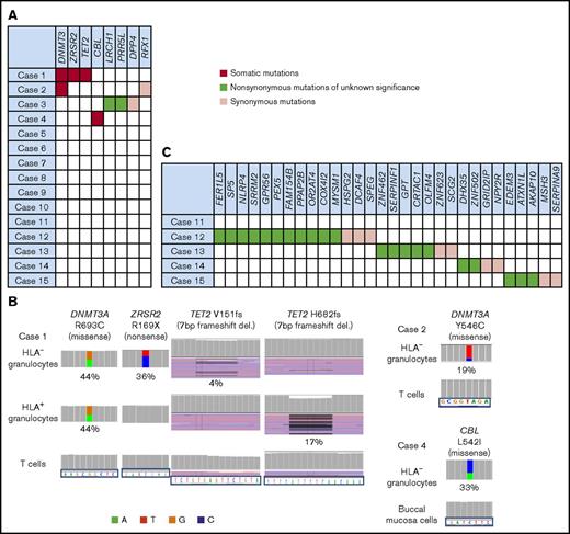Figure 1. The somatic mutations detected in HLA−granulocytes. (A) A summary of targeted sequencing of the 15 cases. Somatic mutations (red), nonsynonymous mutations of unknown significance (green), and synonymous mutations (pink) are shown. (B) The somatic mutations in HLA− granulocytes and HLA+ granulocytes (left, DNMT3A, ZRSR2 and TET2 mutations in case 1; top right, a DNMT3A mutation in case 2; bottom right, a CBL mutation in case 4). HLA+ granulocytes of cases 2 and 3 were not assessable due to the paucity of the cell populations. Two different TET2 frameshift mutations were detected in case 1’s HLA− granulocytes and HLA+ granulocytes, respectively. (C) The somatic mutations detected by whole-exome sequencing (WES) in 5 cases. del., deletion.