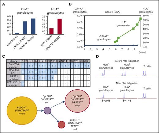 Figure 2. The clonal expansion of HLA-A24−granulocytes associated with secondary somatic mutations in case 1. (A) The somatic mutations detected in both HLA-A24− and HLA-A24+ granulocytes and their VAFs. The numbers of nucleotide positions where mutation occurred and the resultant amino acid replacement are shown at the bottom. (B) The changes in the percentages of GPI-AP− granulocytes and HLA-A24− granulocytes during the 10-year observation period. (C) The genotypes of 21 colonies derived from PB non-T–nonadherent cells. Positivity for the amplified product of A*24:02, mutated DNMT3A, mutated ZRSR2, and mutated TET2 sequences (top panel) and their summary (bottom panel) are shown. (D) The results of HUMARA for HLA-A24− and A24+ granulocytes. Similarly skewed XCI patterns were observed in the 2 granulocyte populations in which the S scores (2.58) in HLA-A24− were higher than those in A24+ granulocyte populations (1.48), suggesting the overwhelming expansion of an HLA-A24−DNMT3AmutZRSR2mut HSPC. SAA, severe aplastic anemia.